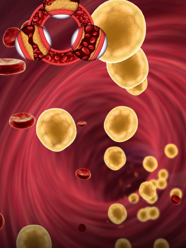 हाई कॉलेस्ट्रोल में दवा की तरह काम करती हैं ये सब्जियां